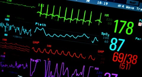 Heart monitor